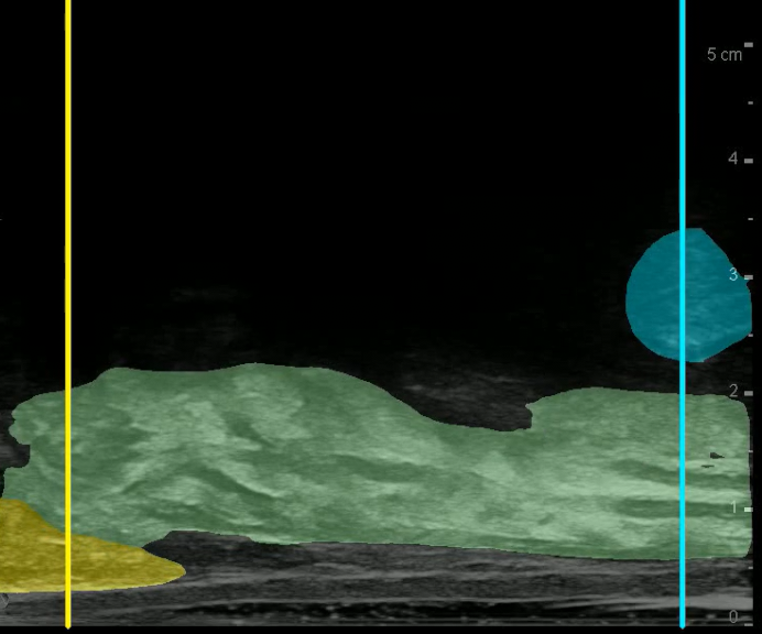 mockup